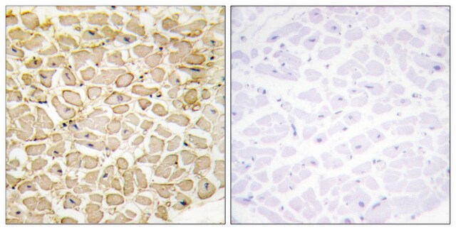 Anti-CDH13 antibody produced in rabbit affinity isolated antibody