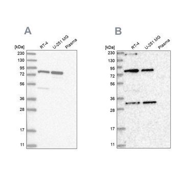 Anti-NOA1 antibody produced in rabbit Prestige Antibodies&#174; Powered by Atlas Antibodies, affinity isolated antibody, buffered aqueous glycerol solution