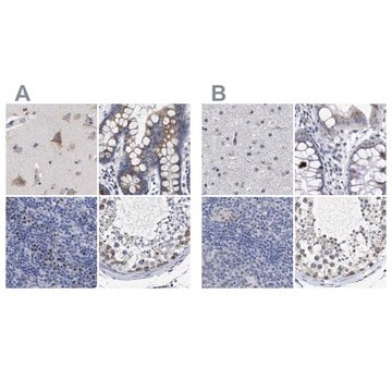 Anti-GOLGA2 antibody produced in rabbit Prestige Antibodies&#174; Powered by Atlas Antibodies, affinity isolated antibody, buffered aqueous glycerol solution