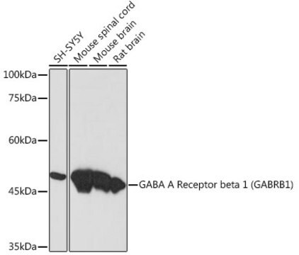 Anti-GABA A Receptor beta 1 (GABRB1) Antibody, clone 1Q3A9, Rabbit Monoclonal