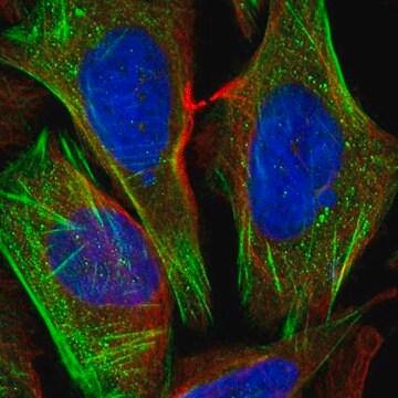 Anti-CSGALNACT1 antibody produced in rabbit Prestige Antibodies&#174; Powered by Atlas Antibodies, affinity isolated antibody