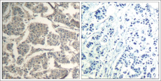 Anti-CCFL1/CFL2 (Ab-88) antibody produced in rabbit affinity isolated antibody