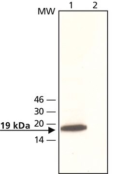 Anti-OMP in Kaninchen hergestellte Antikörper ~2&#160;mg/mL, affinity isolated antibody, buffered aqueous solution