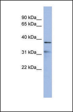 Anti-HEY2 antibody produced in rabbit affinity isolated antibody