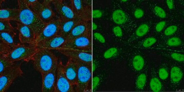 Anti-PHD finger protein 14 (PHF14) from rabbit, purified by affinity chromatography