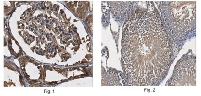 Anti-DMRT2 Antibody | ABE1364 from rabbit, purified by affinity chromatography