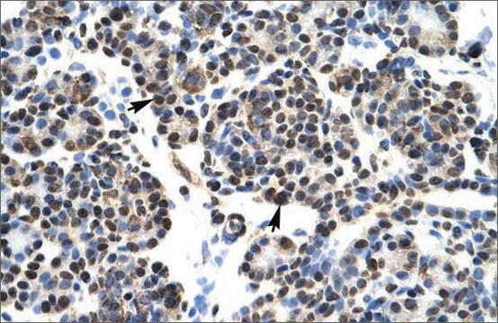 Anti-HOXB5 antibody produced in rabbit affinity isolated antibody