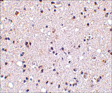 Anti-TMP21 (ab2) antibody produced in rabbit affinity isolated antibody, buffered aqueous solution