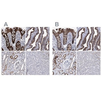 Anti-MKS1 antibody produced in rabbit Prestige Antibodies&#174; Powered by Atlas Antibodies, affinity isolated antibody, buffered aqueous glycerol solution, Ab1