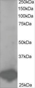 Anti-BCAP31/BAP31 antibody produced in goat affinity isolated antibody, buffered aqueous solution