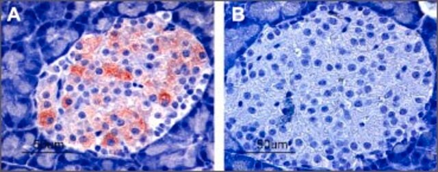 Anti-Potassium Channel Kir6.2 antibody produced in rabbit affinity isolated antibody, lyophilized powder