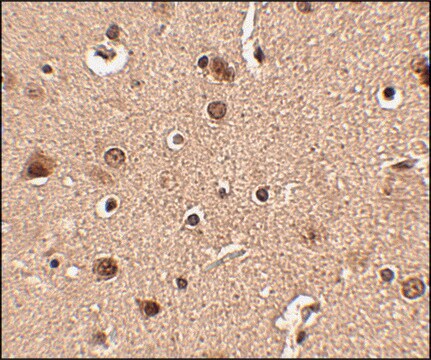 Anti-Slitrk4 antibody produced in rabbit affinity isolated antibody, buffered aqueous solution