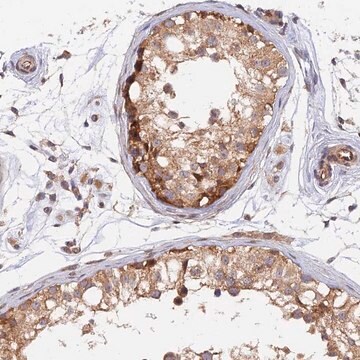 Anti-WDR41 antibody produced in rabbit Prestige Antibodies&#174; Powered by Atlas Antibodies, affinity isolated antibody, buffered aqueous glycerol solution