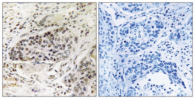 Anti-APBA2 antibody produced in rabbit affinity isolated antibody