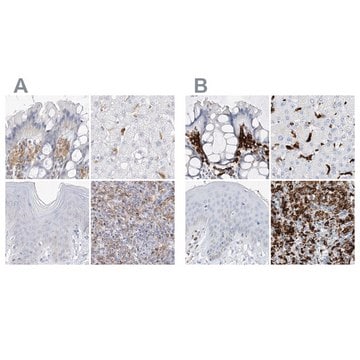 Anti-TBXAS1 antibody produced in rabbit Prestige Antibodies&#174; Powered by Atlas Antibodies, affinity isolated antibody, buffered aqueous glycerol solution