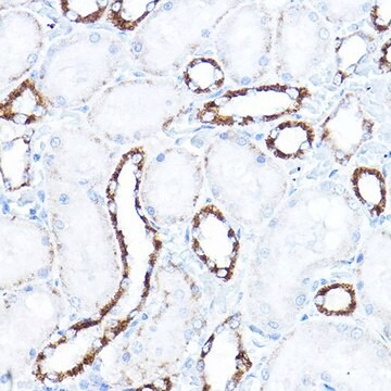 Anti- HK1 antibody produced in rabbit