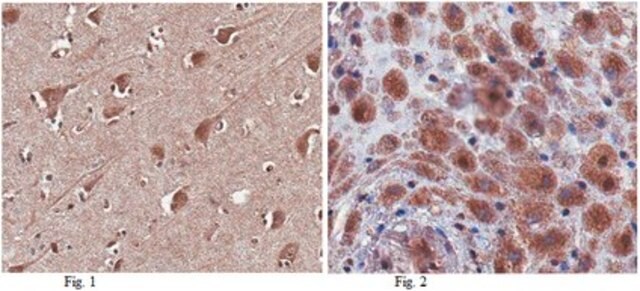 Anti-SAPAP1 Antibody from rabbit, purified by affinity chromatography