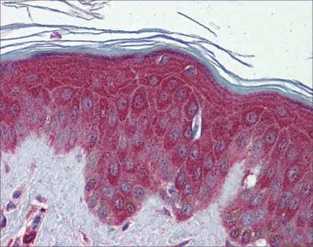 Anti-PRDX6 (AB1) antibody produced in rabbit affinity isolated antibody