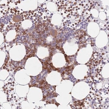 Anti-PPM1A antibody produced in rabbit Prestige Antibodies&#174; Powered by Atlas Antibodies, affinity isolated antibody, buffered aqueous glycerol solution