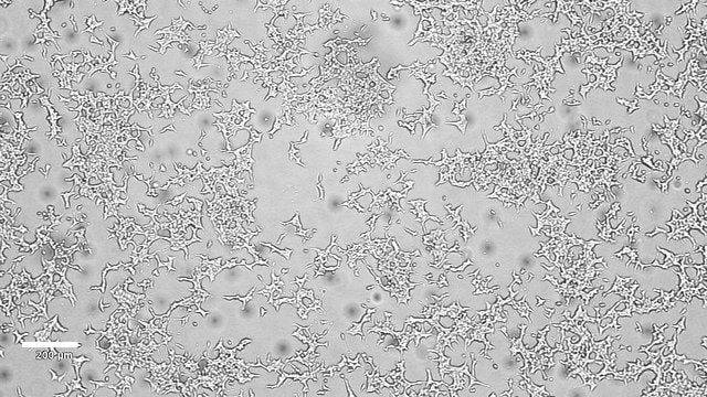 GRINCH Glucose-Responsive Insulin-secreting C-peptide hProinsulin Rat Insulinoma Cell Line