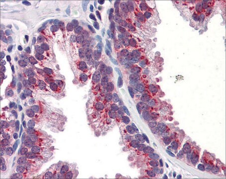 Anti-KLF4 antibody produced in rabbit affinity isolated antibody