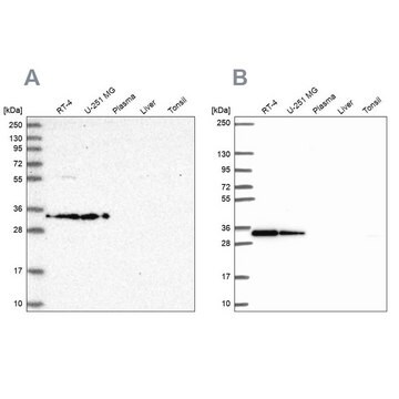 Anti-RPS3A antibody produced in rabbit Prestige Antibodies&#174; Powered by Atlas Antibodies, affinity isolated antibody, buffered aqueous glycerol solution