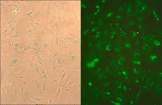 Human Lung Fibroblasts: HLF, fetal