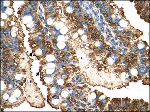 Anti-PGK1 antibody produced in rabbit IgG fraction of antiserum