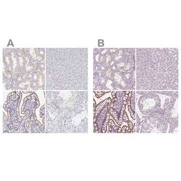 Anti-MISP antibody produced in rabbit Prestige Antibodies&#174; Powered by Atlas Antibodies, affinity isolated antibody, buffered aqueous glycerol solution