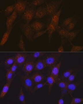 Anti-PSMD4 antibody produced in rabbit