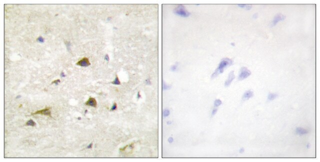 Anti-IKK-&#946; antibody produced in rabbit affinity isolated antibody