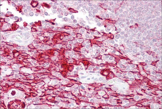 Anti-ATF1 (AB2) antibody produced in rabbit affinity isolated antibody