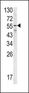 ANTI-FIBB(N-TERMINAL) antibody produced in rabbit purified immunoglobulin, buffered aqueous solution