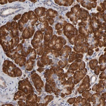 Anti-HDLBP antibody produced in rabbit Prestige Antibodies&#174; Powered by Atlas Antibodies, affinity isolated antibody, buffered aqueous glycerol solution