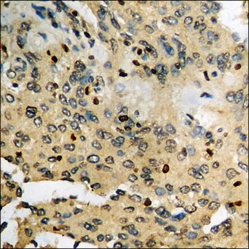 Anti-phospho-CK-1 &#945; (pTyr294) antibody produced in rabbit affinity isolated antibody