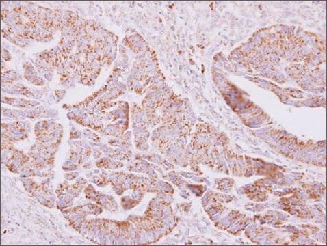 Anti-ST6GALNAC2 antibody produced in rabbit affinity isolated antibody, buffered aqueous solution