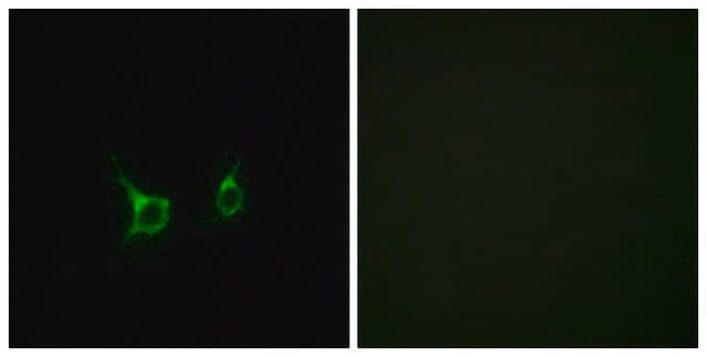 Anti-FFAR2 antibody produced in rabbit affinity isolated antibody