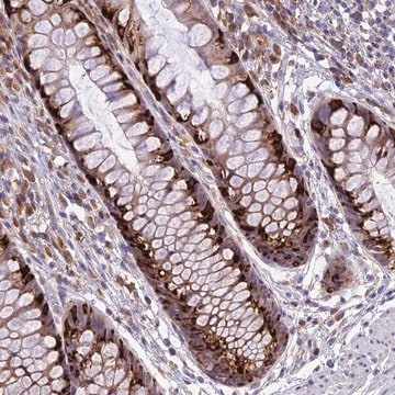 Anti-ARMCX6 antibody produced in rabbit Prestige Antibodies&#174; Powered by Atlas Antibodies, affinity isolated antibody, buffered aqueous glycerol solution