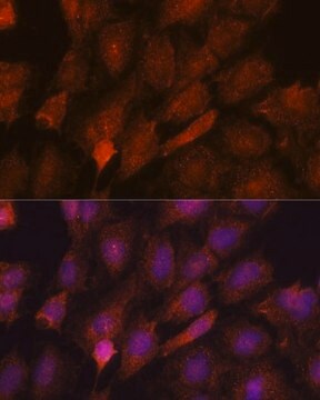 Anti-SMYD3 antibody produced in rabbit