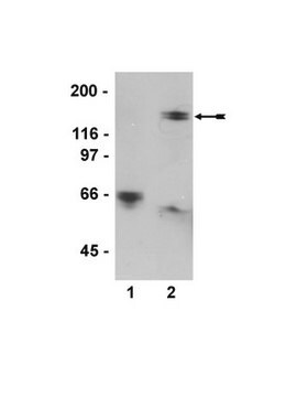 Anti-phospho-MYPT1 (Thr850) Antibody, clone SA19, rabbit monoclonal clone SA19, Upstate&#174;, from rabbit