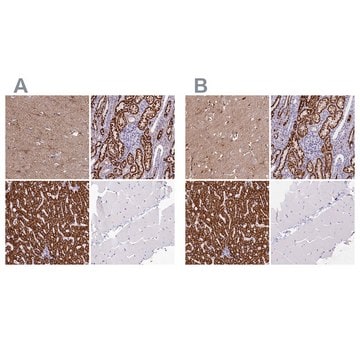 Anti-ABAT antibody produced in rabbit Prestige Antibodies&#174; Powered by Atlas Antibodies, affinity isolated antibody, buffered aqueous glycerol solution