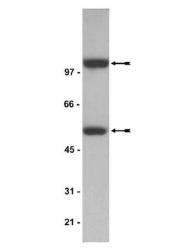 Anticuerpo anti-NF&#954;B p52 Upstate&#174;, from mouse