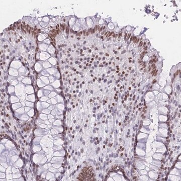 Anti-HMGN1 antibody produced in rabbit Prestige Antibodies&#174; Powered by Atlas Antibodies, affinity isolated antibody, buffered aqueous glycerol solution