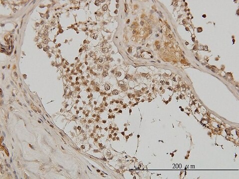 Monoclonal Anti-ACTN4 antibody produced in mouse clone 4D10, purified immunoglobulin, buffered aqueous solution