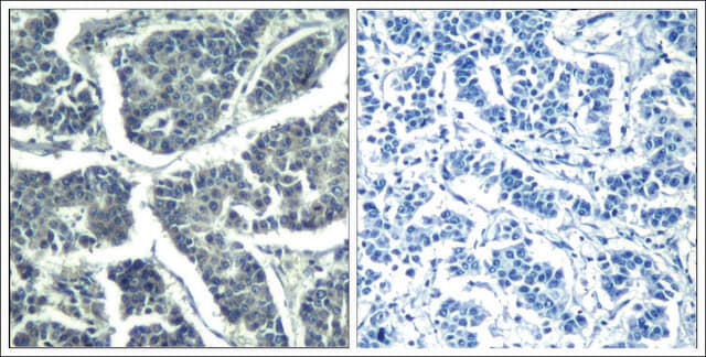 Anti-phospho-PLCG2 (pTyr1217) antibody produced in rabbit affinity isolated antibody