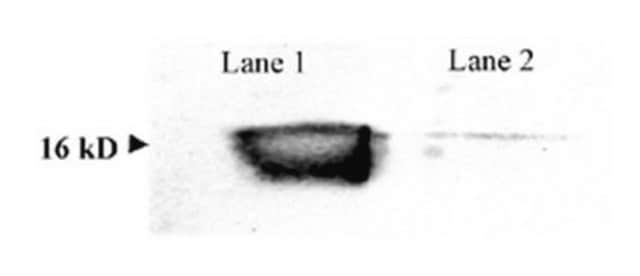 Anti-Superoxide Dismutase 1 Antibody serum, Chemicon&#174;