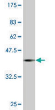 ANTI-PRDM1 antibody produced in mouse clone 4A6, purified immunoglobulin, buffered aqueous solution