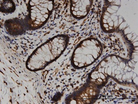 Monoclonal Anti-TRAM2, (C-terminal) antibody produced in mouse clone 3G6, purified immunoglobulin, buffered aqueous solution