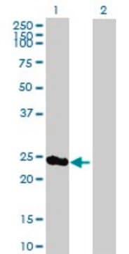 Anti-PSMD8 antibody produced in mouse purified immunoglobulin, buffered aqueous solution