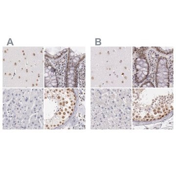 Anti-DGCR14 antibody produced in rabbit Ab1, Prestige Antibodies&#174; Powered by Atlas Antibodies, affinity isolated antibody, buffered aqueous glycerol solution